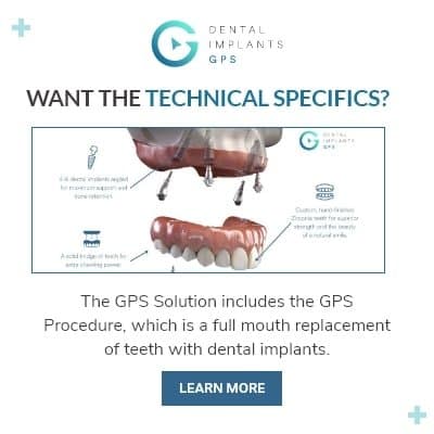 Dental Implants GPS facility photo
