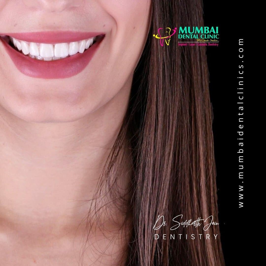Mumbai Dental Clinic & Implant Centre : Udaipur facility photo