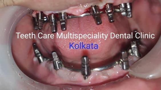 Teeth Care Multispeciality Dental Clinic facility photo