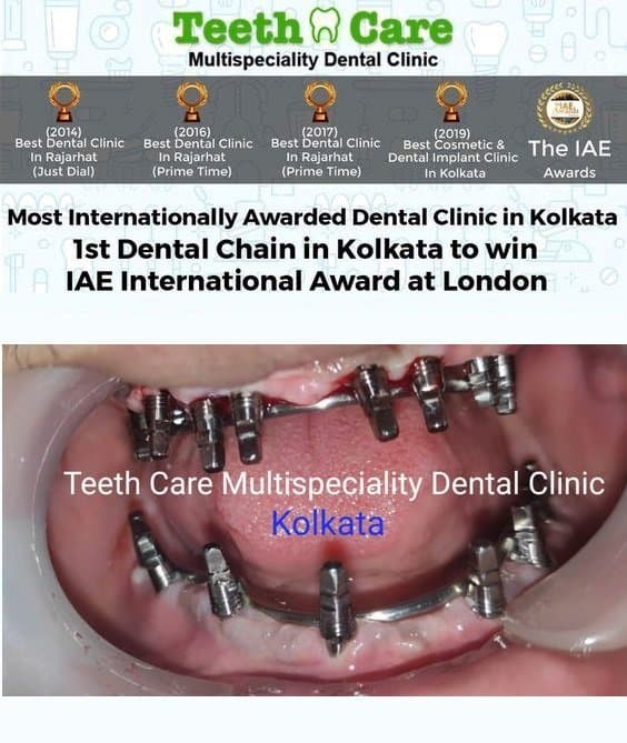 Teeth Care Multispeciality Dental Clinic facility photo