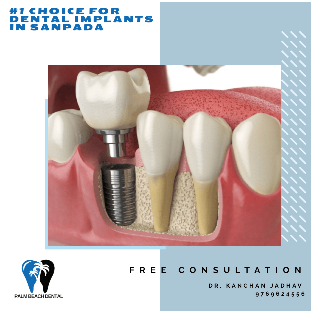 Palm Beach Dental Clinic in Sanpada facility photo