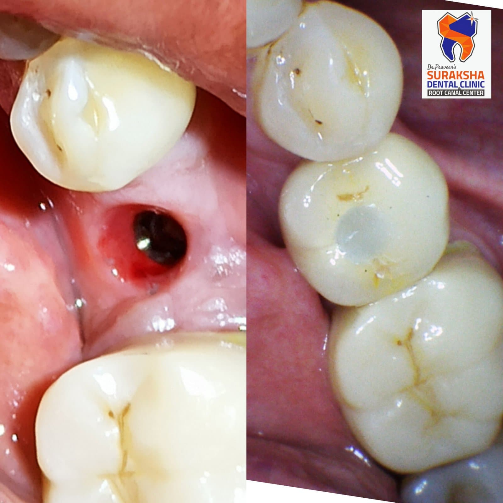 Suraksha Dental Clinic facility photo