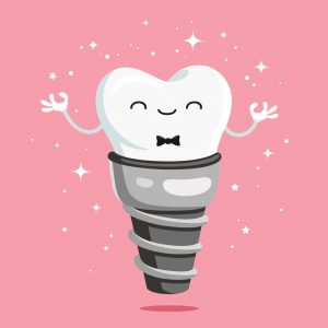 Tips for Helping Your Implants Last